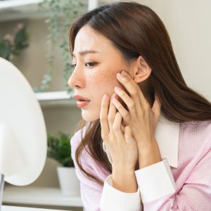 Dark Spots Treatment Near Me in New York, NY