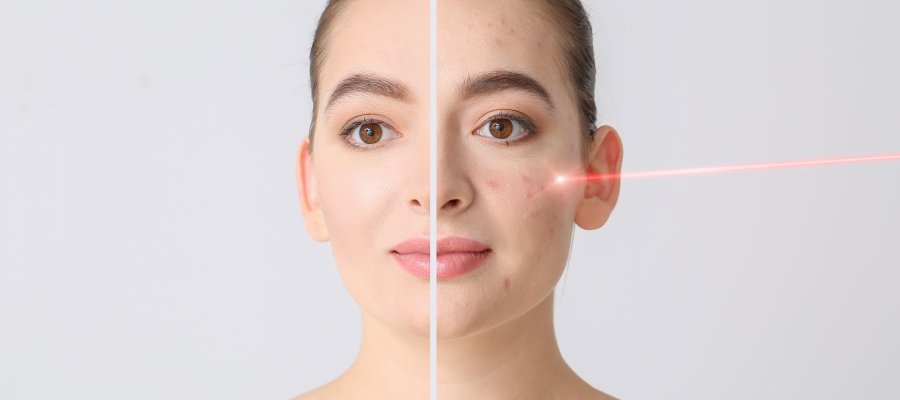 Fraxel Laser at Donnelley Dermatology, PLLC in New York, NY