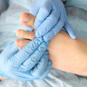 Fungal Infections Treatment Near Me in New York, NY