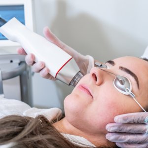 Microneedling Treatment Near Me in New York, NY