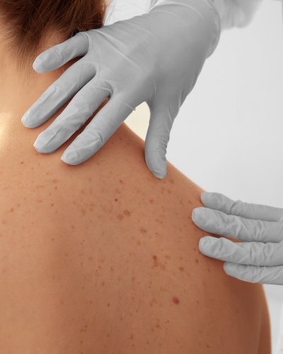 Surgical Dermatology Near Me in New York, NY