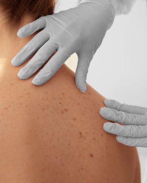 Surgical Dermatology Near Me in New York, NY