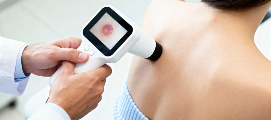 How to Identify Early Signs of Skin Cancer and When to Get Screened in New York, NY