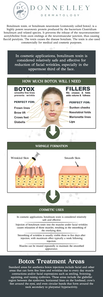 Botox is a popular non-surgical treatment designed to reduce the appearance of fine lines and wrinkles caused by facial expressions. It works by temporarily relaxing the muscles that cause dynamic wrinkles, such as frown lines, crow’s feet, and forehead lines. The procedure is quick, minimally invasive, and requires little to no downtime. At Donnelley Dermatology in New York, NY, Dr. Naomi S. Donnelley, M.D., FAAD, a board-certified dermatologist, offers expert Botox treatments to help you achieve a youthful, refreshed appearance. For more information, contact us or schedule an appointment online. We are conveniently located at 1075 Park Ave , #1C, New York, NY, 10128. Botox is a popular non-surgical treatment designed to reduce the appearance of fine lines and wrinkles caused by facial expressions. It works by temporarily relaxing the muscles that cause dynamic wrinkles, such as frown lines, crow’s feet, and forehead lines. The procedure is quick, minimally invasive, and requires little to no downtime. At Donnelley Dermatology in New York, NY, Dr. Naomi S. Donnelley, M.D., FAAD, a board-certified dermatologist, offers expert Botox treatments to help you achieve a youthful, refreshed appearance. For more information, contact us or schedule an appointment online. We are conveniently located at 1075 Park Ave , #1C, New York, NY, 10128.
