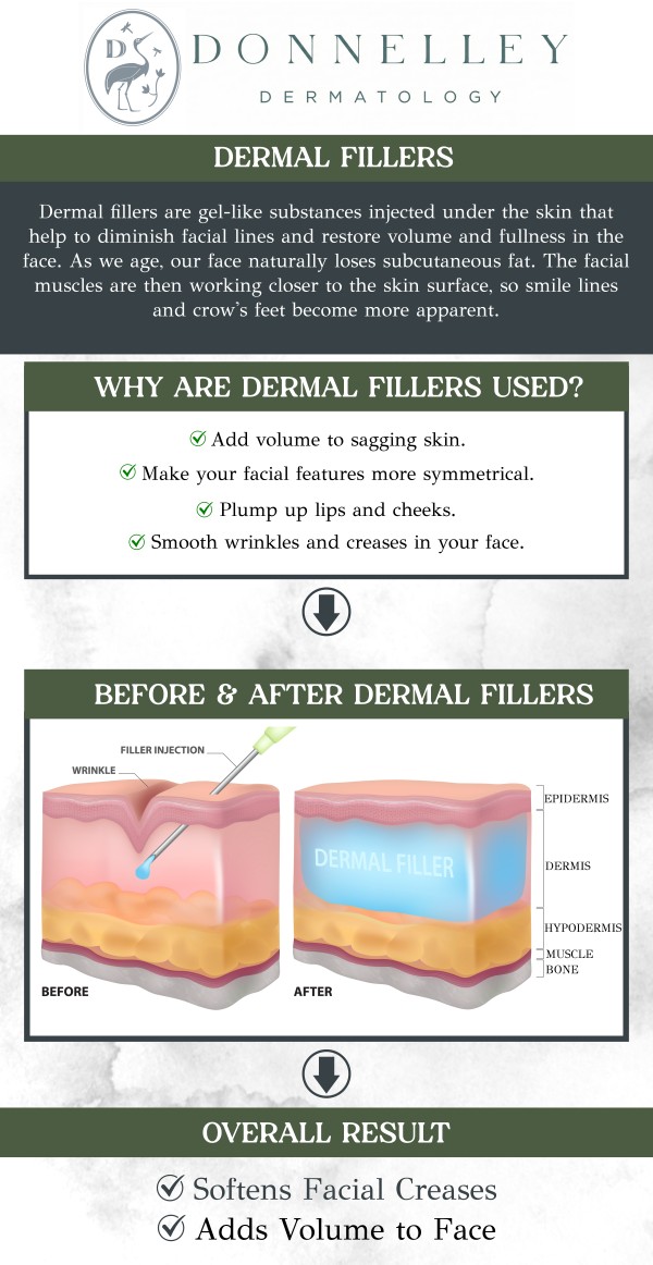 Common questions asked by clients: What are dermal fillers? What types of fillers are available? How long does a filler treatment session take? Is there any downtime after receiving fillers? How quickly will results be visible after fillers? Can fillers be used to treat wrinkles and fine lines? Dermal fillers at Donnelley Dermatology restore facial volume, smooth wrinkles, and enhance contours. Under the care of board-certified dermatologist Dr. Naomi Donnelley, MD, FAAD, these non-surgical treatments provide immediate results with minimal downtime. For more information, contact us or schedule an appointment online. We are conveniently located at 1075 Park Ave , #1C, New York, NY, 10128.