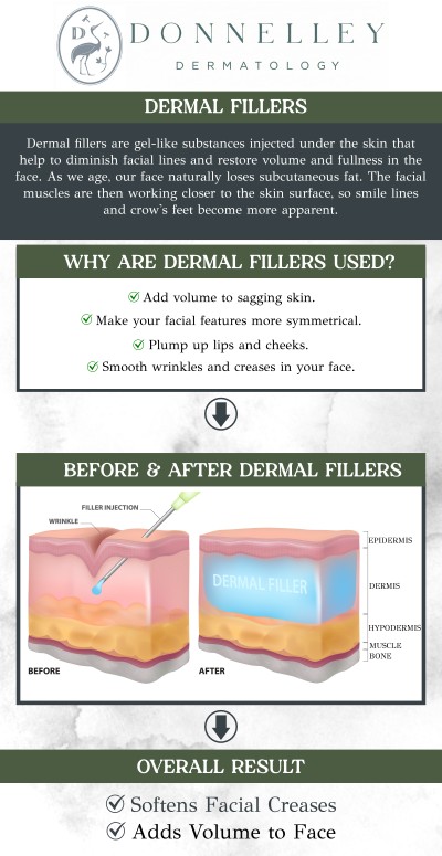 Common questions asked by clients: What are dermal fillers? What types of fillers are available? How long does a filler treatment session take? Is there any downtime after receiving fillers? How quickly will results be visible after fillers? Can fillers be used to treat wrinkles and fine lines? Dermal fillers at Donnelley Dermatology restore facial volume, smooth wrinkles, and enhance contours. Under the care of board-certified dermatologist Dr. Naomi Donnelley, MD, FAAD, these non-surgical treatments provide immediate results with minimal downtime. For more information, contact us or schedule an appointment online. We are conveniently located at 1075 Park Ave , #1C, New York, NY, 10128.