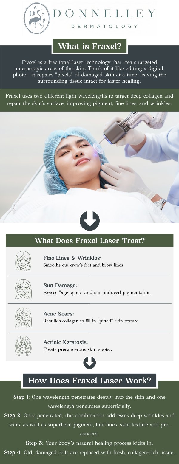 Fraxel laser treatment is a non-invasive procedure designed to improve skin texture, tone, and appearance by stimulating collagen production. It works by delivering microbeams of laser energy to the skin, targeting both superficial and deeper layers to promote skin rejuvenation and reduce imperfections like wrinkles, sunspots, and acne scars. The treatment is customized to each patient’s skin concerns, with minimal downtime and gradual, natural-looking results. Under the care of Dr. Naomi S. Donnelley, MD, FAAD, a board-certified dermatologist, Fraxel effectively enhances skin health and radiance, leaving you with smoother, more youthful skin. For more information, contact us or schedule an appointment online. We are conveniently located at 1075 Park Ave , #1C, New York, NY, 10128.