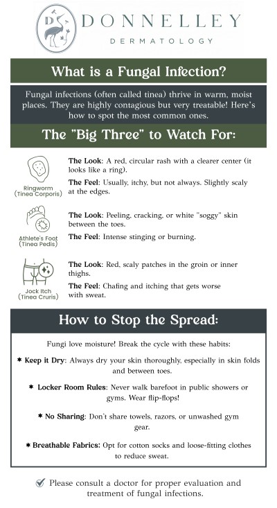 Common questions asked by patients: What are fungal infections? What causes fungal infections? How are fungal infections diagnosed? What are the most common types of fungal infections? Are fungal infections contagious? Fungal infections are common skin conditions caused by fungi that can affect various parts of the body. Dr. Naomi Donnelley, MD, FAAD, a board-certified dermatologist at Donnelley Dermatology, PLLC in New York, NY, provides effective treatments to manage and eliminate fungal infections. With personalized care, Dr. Donnelley ensures safe and timely recovery for optimal skin health. For more information, contact us or schedule an appointment online. We are conveniently located at 1075 Park Ave , #1C, New York, NY, 10128. Common questions asked by patients: What are fungal infections? What causes fungal infections? How are fungal infections diagnosed? What are the most common types of fungal infections? Are fungal infections contagious? Fungal infections are common skin conditions caused by fungi that can affect various parts of the body. Dr. Naomi Donnelley, MD, FAAD, a board-certified dermatologist at Donnelley Dermatology, PLLC in New York, NY, provides effective treatments to manage and eliminate fungal infections. With personalized care, Dr. Donnelley ensures safe and timely recovery for optimal skin health. For more information, contact us or schedule an appointment online. We are conveniently located at 1075 Park Ave , #1C, New York, NY, 10128.