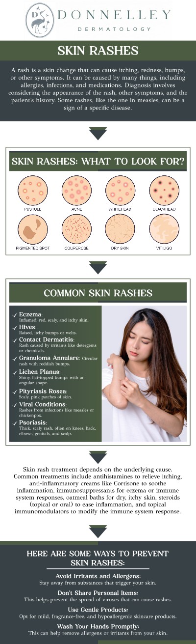 Rashes are common skin irritations that can be caused by various factors, including allergies, infections, or skin conditions like eczema. Symptoms typically include redness, itching, and swelling, with the appearance varying depending on the cause. Dr. Naomi S. Donnelley, a board-certified dermatologist at Donnelley Dermatology, PLLC, can provide proper diagnosis and treatment for rashes. For more information, contact us or schedule an appointment online. We are conveniently located at 1075 Park Ave , #1C, New York, NY, 10128.