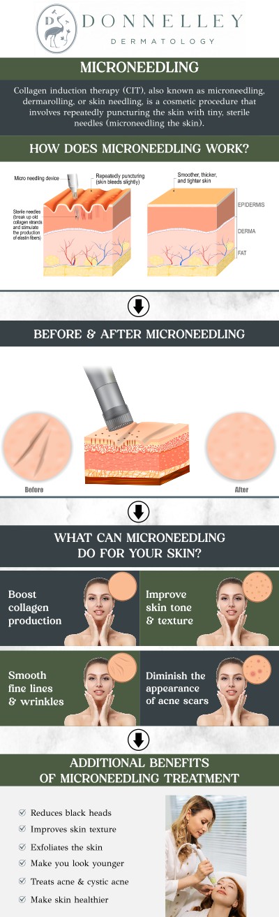 Microneedling is a minimally invasive procedure that stimulates collagen production by creating tiny, controlled micro-injuries in the skin. This treatment helps improve skin texture, reduce fine lines, and minimize acne scars, leaving you with a smoother, more youthful appearance. At Donnelley Dermatology, Dr. Naomi S. Donnelley, MD, FAAD, a board-certified dermatologist, tailors each microneedling session to your unique skin needs, ensuring optimal results. Experience smoother, more radiant skin with minimal downtime by scheduling a consultation today! For more information, contact us or schedule an appointment online. We are conveniently located at 1075 Park Ave , #1C, New York, NY, 10128. Microneedling is a minimally invasive procedure that stimulates collagen production by creating tiny, controlled micro-injuries in the skin. This treatment helps improve skin texture, reduce fine lines, and minimize acne scars, leaving you with a smoother, more youthful appearance. At Donnelley Dermatology, Dr. Naomi S. Donnelley, MD, FAAD, a board-certified dermatologist, tailors each microneedling session to your unique skin needs, ensuring optimal results. Experience smoother, more radiant skin with minimal downtime by scheduling a consultation today! For more information, contact us or schedule an appointment online. We are conveniently located at 1075 Park Ave , #1C, New York, NY, 10128.