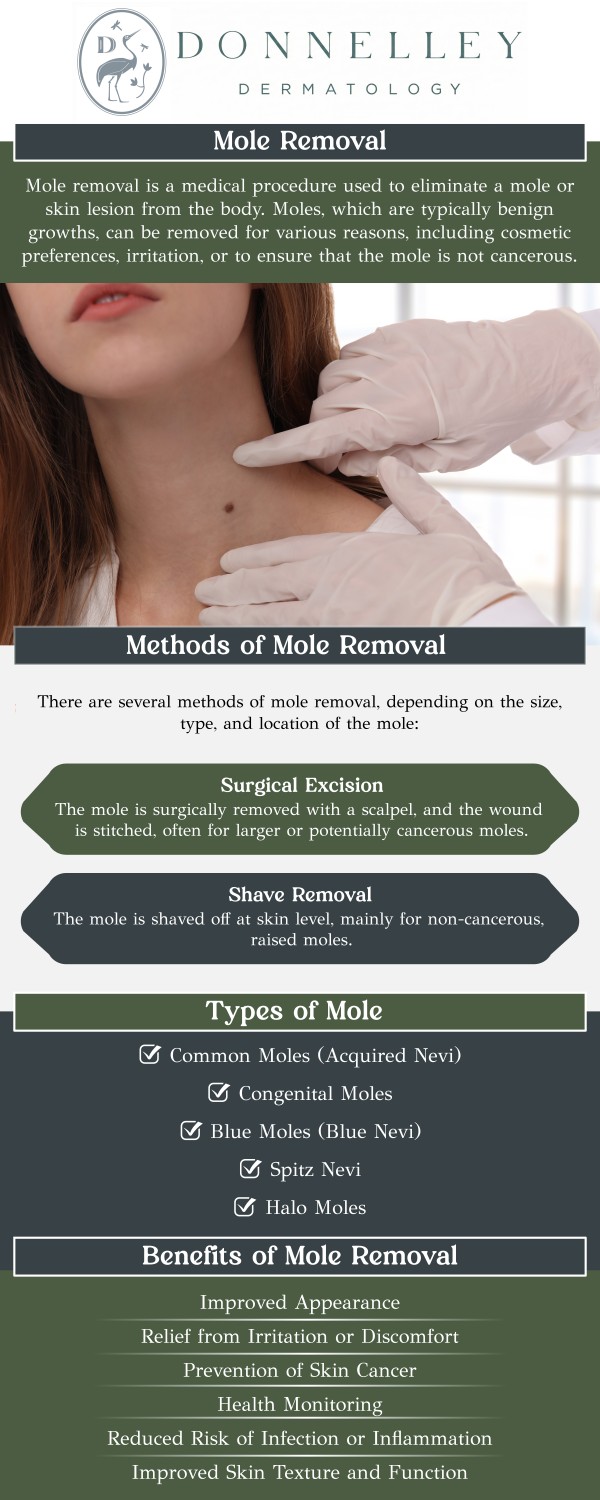 Cosmetic mole removal is a safe, minimally invasive procedure designed to remove unwanted or bothersome moles for cosmetic or medical reasons. At Donnelley Dermatology, Dr. Naomi S. Donnelley, MD, FAAD, a board-certified dermatologist, uses advanced techniques such as excision to remove moles with precision and minimal downtime. This treatment is ideal for those seeking to improve their skin’s appearance or address moles that cause irritation. The procedure is quick, and the recovery is typically fast, with minimal scarring and excellent cosmetic outcomes. For more information, contact us or schedule an appointment online. We are conveniently located at 1075 Park Ave , #1C, New York, NY, 10128.