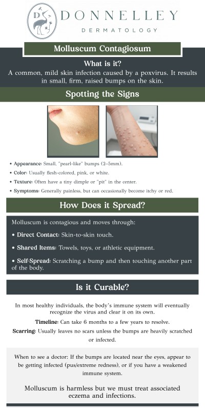 Common questions asked by patients: What is Molluscum Contagiosum? How does Molluscum Contagiosum spread? What are the symptoms of Molluscum Contagiosum? Is Molluscum Contagiosum contagious? How is Molluscum Contagiosum diagnosed? Molluscum Contagiosum is a viral skin infection that causes small, raised, round bumps on the skin. It spreads through direct contact or by sharing personal items, and is most common in children but can affect adults as well. Dr. Naomi S. Donnelley, a board-certified dermatologist at Donnelley Dermatology, PLLC, offers effective treatment options to manage and treat Molluscum Contagiosum. For more information, contact us or schedule an appointment online. We are conveniently located at 1075 Park Ave , #1C, New York, NY, 10128. Common questions asked by patients: What is Molluscum Contagiosum? How does Molluscum Contagiosum spread? What are the symptoms of Molluscum Contagiosum? Is Molluscum Contagiosum contagious? How is Molluscum Contagiosum diagnosed? Molluscum Contagiosum is a viral skin infection that causes small, raised, round bumps on the skin. It spreads through direct contact or by sharing personal items, and is most common in children but can affect adults as well. Dr. Naomi S. Donnelley, a board-certified dermatologist at Donnelley Dermatology, PLLC, offers effective treatment options to manage and treat Molluscum Contagiosum. For more information, contact us or schedule an appointment online. We are conveniently located at 1075 Park Ave , #1C, New York, NY, 10128.