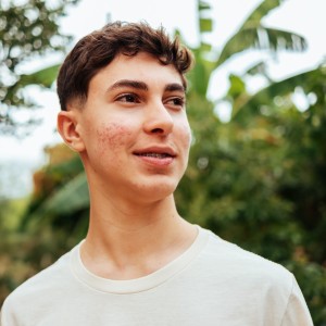 Acne Treatment for Pediatrics in New York, NY