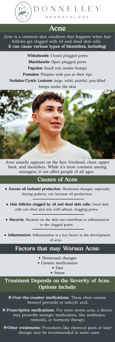 Common questions asked by patients: What causes acne in children and teens? Is acne normal in children? At what age should my child see a dermatologist for acne? How long does it take for acne treatment to work? At Donnelley Dermatology, PLLC, Dr. Naomi S. Donnelley, a board-certified dermatologist, provides comprehensive pediatric acne treatment tailored to the unique physiological and emotional needs of younger patients. Her approach focuses on developing gentle, effective regimens that prioritize a child's confidence and long-term skin health. Our NYC practice ensures every young patient receives the thorough examination and personalized education necessary to successfully manage their skin from childhood through adolescence. For more information, contact us or schedule an appointment online. We are conveniently located at 1075 Park Ave , #1C, New York, NY, 10128.