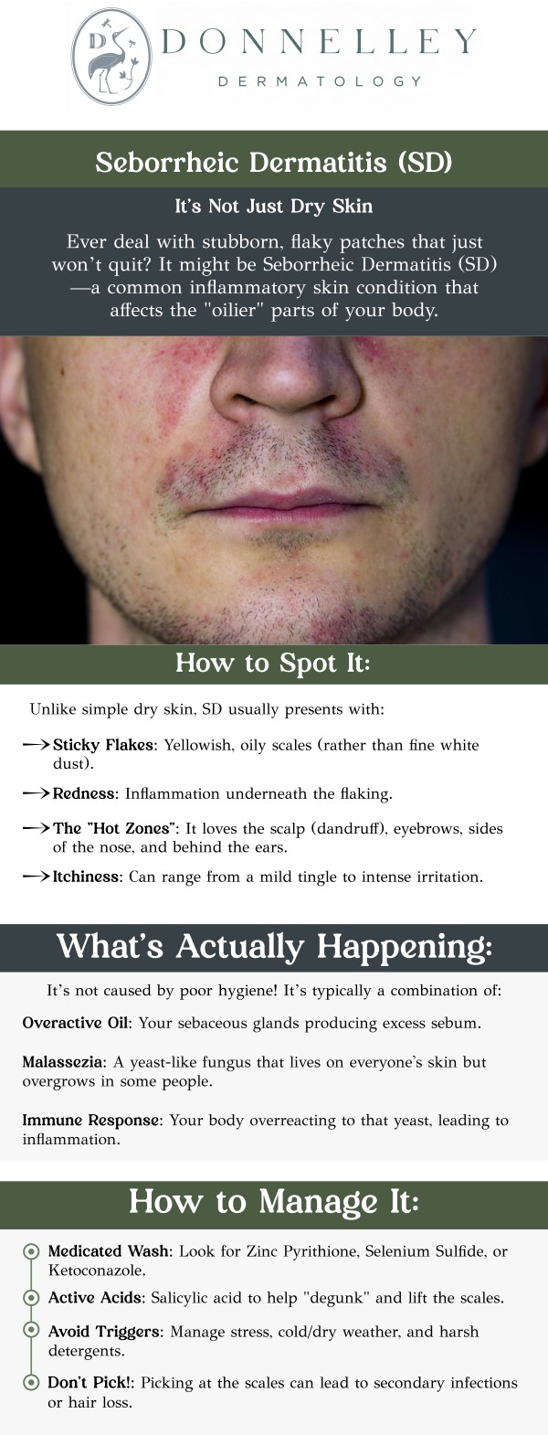 Common questions asked by patients: What is Seborrheic Dermatitis? What causes Seborrheic Dermatitis? What are the symptoms of Seborrheic Dermatitis? How is Seborrheic Dermatitis diagnosed? Seborrheic Dermatitis is a common skin condition that causes red, scaly patches, primarily on the scalp, face, and other oily areas of the body. It is often triggered by factors such as stress, weather changes, and an overgrowth of yeast. Dr. Naomi S. Donnelley, a board-certified dermatologist at Donnelley Dermatology, PLLC in New York, NY, provides effective care to help control seborrheic dermatitis and reduce flare-ups. For more information, contact us or schedule an appointment online. We are conveniently located at 1075 Park Ave , #1C, New York, NY, 10128.