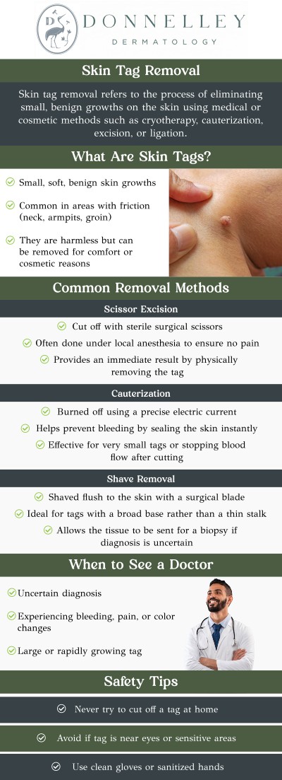 Common questions asked by patients: What are skin tags? What causes skin tags to form? Can skin tags be removed? What are the treatment options for removing skin tags? Can skin tags grow back after removal? Can skin tags grow back after removal? Skin tags are small, soft growths that often appear on areas of the skin where there is friction, such as the neck, armpits, or under the breasts. While generally harmless, they can be bothersome or unsightly for some individuals. Skin tag removal is a simple procedure with minimal risk of scarring. Dr. Naomi Donnelley, MD, FAAD, a board-certified dermatologist, offers safe and effective removal options at Donnelley Dermatology, PLLC in New York, NY. For more information, contact us or schedule an appointment online. We are conveniently located at 1075 Park Ave , #1C, New York, NY, 10128.