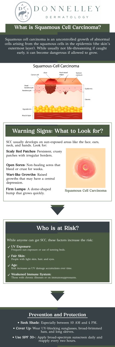 Common questions asked by patients: What is squamous cell carcinoma? How can I recognize squamous cell carcinoma? How does my dermatologist diagnose squamous cell carcinoma? What is the treatment for squamous cell carcinoma? Squamous Cell Carcinoma (SCC) is a type of skin cancer that develops in the squamous cells, often caused by excessive sun exposure or tanning bed use. It can appear as a firm, red nodule or a flat sore with a scaly crust. Early detection is key to effective treatment, and Dr. Naomi Donnelley, MD, FAAD, a board-certified dermatologist, provides personalized care at Donnelley Dermatology, PLLC in New York, NY. Timely treatment can help prevent the spread and improve outcomes for patients with SCC. For more information, contact us or schedule an appointment online. We are conveniently located at 1075 Park Ave , #1C, New York, NY, 10128. Common questions asked by patients: What is squamous cell carcinoma? How can I recognize squamous cell carcinoma? How does my dermatologist diagnose squamous cell carcinoma? What is the treatment for squamous cell carcinoma? Squamous Cell Carcinoma (SCC) is a type of skin cancer that develops in the squamous cells, often caused by excessive sun exposure or tanning bed use. It can appear as a firm, red nodule or a flat sore with a scaly crust. Early detection is key to effective treatment, and Dr. Naomi Donnelley, MD, FAAD, a board-certified dermatologist, provides personalized care at Donnelley Dermatology, PLLC in New York, NY. Timely treatment can help prevent the spread and improve outcomes for patients with SCC. For more information, contact us or schedule an appointment online. We are conveniently located at 1075 Park Ave , #1C, New York, NY, 10128.